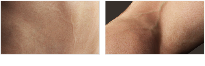 make human skin-vascular