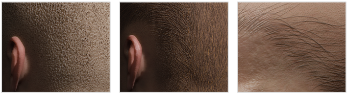 realistic skin-hairline