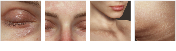 make human skin-coloration